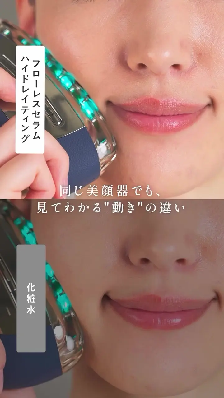 【今週までSALE】ヤーマンリフトロジー プロ 美顔器 今週までSALE】ヤーマンリフトロジー プロ 美顔器