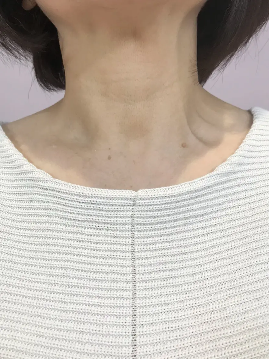 自由区 小森 コーディネート画像