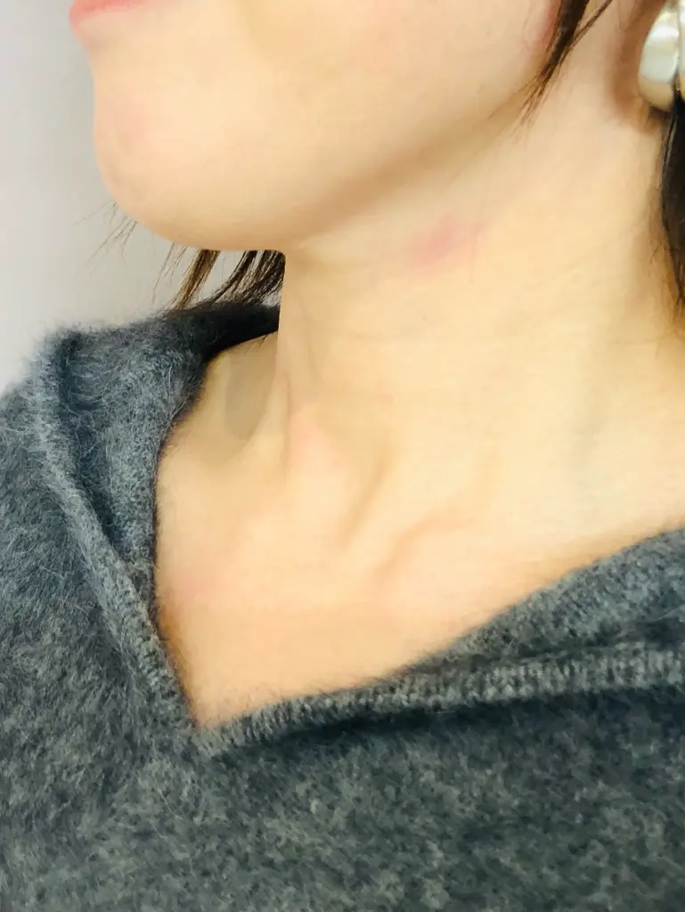 自由区 上島 コーディネート画像